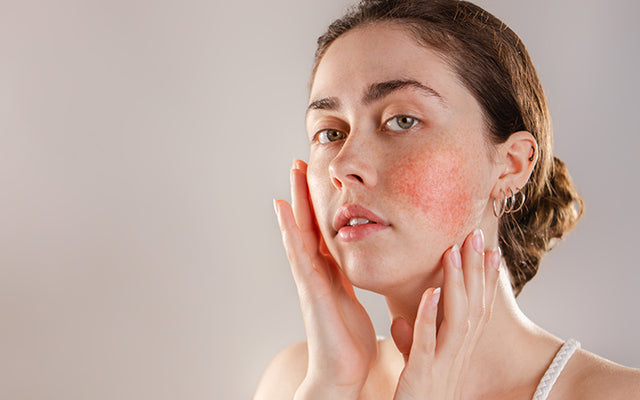 Best Skincare Ingredients for Sensitive Skin