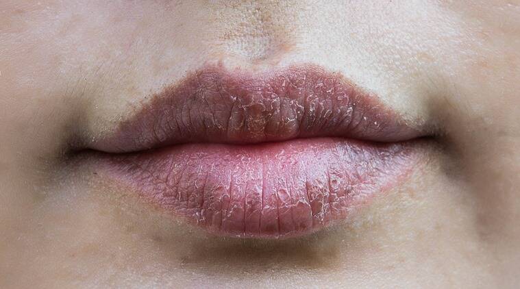 home remedies for dark lips
