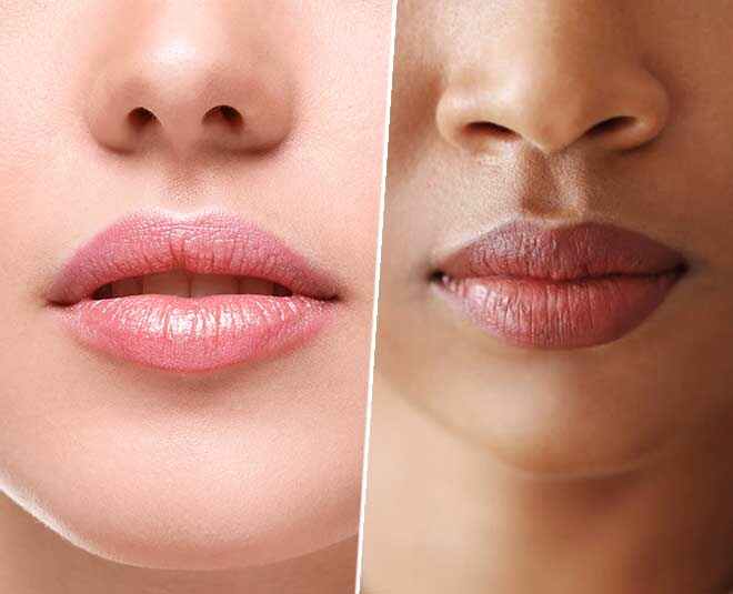 natural home remedies for dark lips